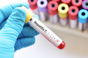 epatite c