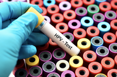 hpv pap test