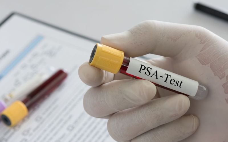 lombardia prevenzione prostata